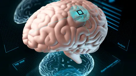Un implant mai mic decât un bob de sare îți poate citi creierul în timp real