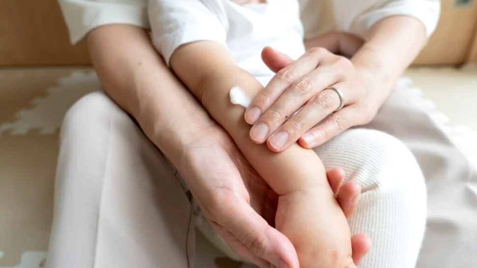 Un unguent experimental ar putea face cicatricele să dispară