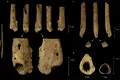Cea mai veche amputație din lume, găsită la un schelet din Neolitic