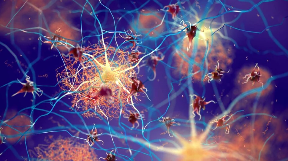 Cercetătorii au descoperit 5 variante biologice de Alzheimer