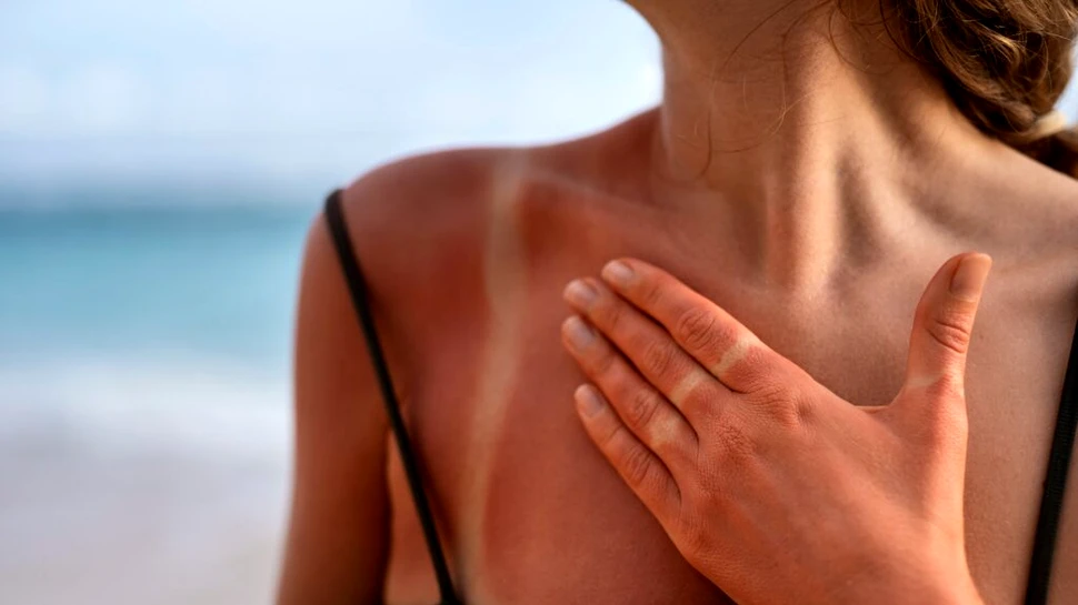 Cazurile noi de cancer de piele au atins un nivel record în Marea Britanie