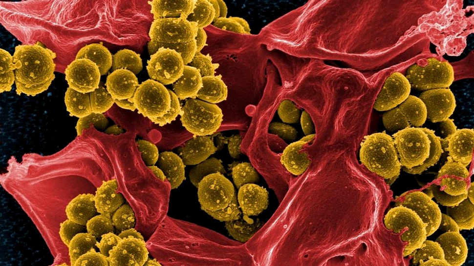 Noi dovezi sugerează că boala Parkinson ar putea fi provocată de un dezechilibru al florei intestinale