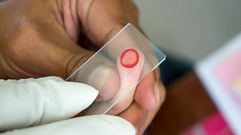 Vaccin revoluţionar împotriva unei infecţii pe care o au mulţi români