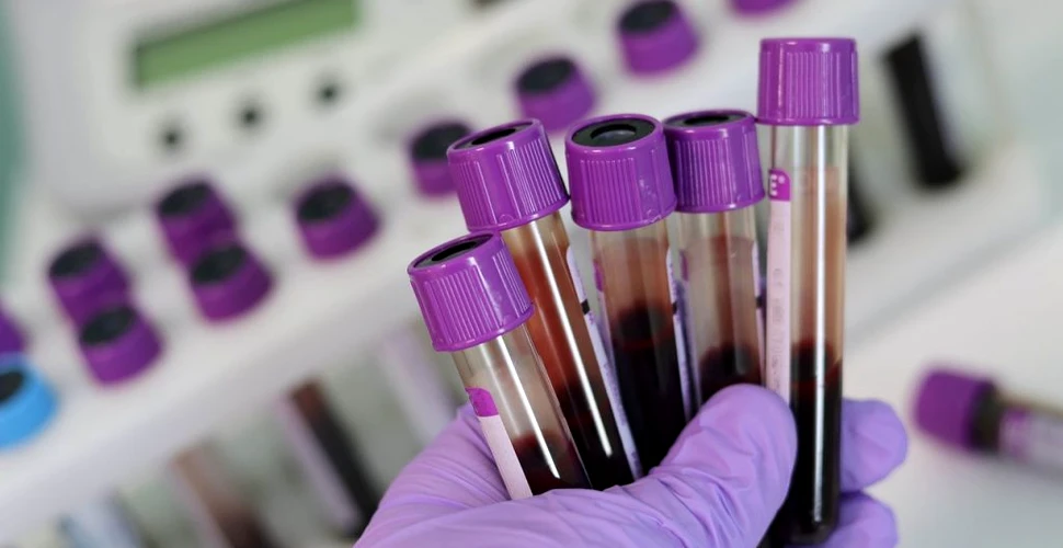 FT: Un studiu dezvăluie grupa de sânge cu risc mai redus de infectare cu noul coronavirus