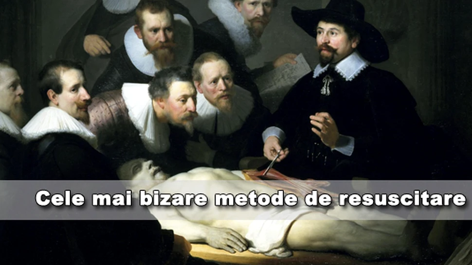 Scurta istorie a celor mai bizare tehnici de resuscitare