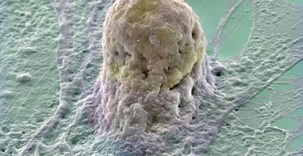 Celulele stem cunosc si “partitura” celulelor nervoase