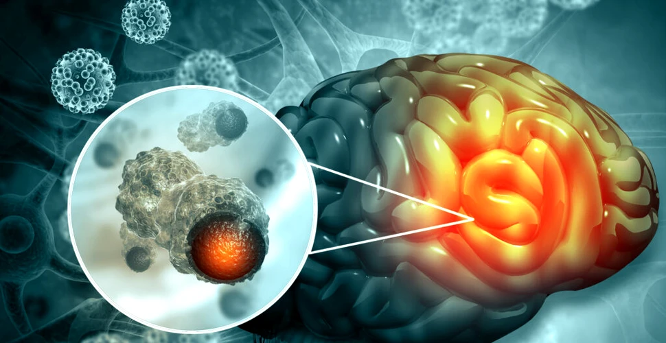Un nou dispozitiv detectează tumorile cerebrale cu ajutorul urinei