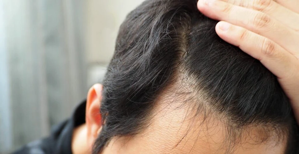 Cercetătorii au manipulat celule stem și au reușit să regenereze părul îmbătrânit