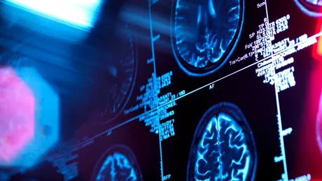 Un studiu pune la îndoială tot ce credeam că știm despre Alzheimer. Care ar fi de fapt cauza bolii?