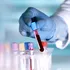 Un nou test de sânge poate depista cancerul cu trei ani înainte de diagnostic