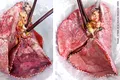 Un experiment a arătat că plămânii umani deteriorați pot fi reparați dacă sunt conectați la porci