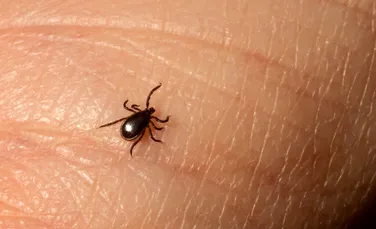 Inteligență Artificială detectează boala Lyme cu o precizie de 90%