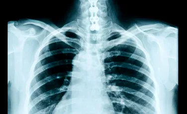 Bolile pulmonare vor putea fi diagnosticate automat cu ajutorul inteligenței artificiale