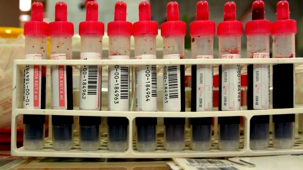 Aminoacizii din sânge îţi spun dacă o să faci diabet