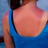 Ce înseamnă SPF, ce este radiația UV și cât de eficiente sunt cremele cu protecție solară