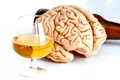 Mai mult alcool, mai puțin creier. Un singur pahar pe zi ne poate micșora creierul, indică un studiu