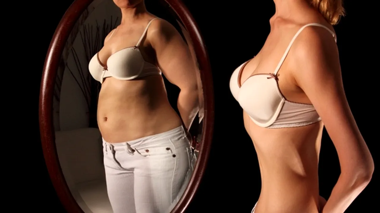 1-anorexia 