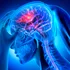 Inteligența Artificială a găsit originea psihozei în creier