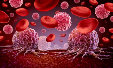 Un nou tratament pentru cel mai agresiv tip de cancer cerebral poate ajuta pacienții să trăiască mai mult