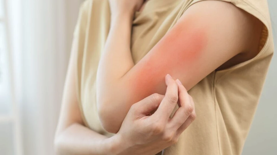 Poți fi alergic la alți oameni? Răspunsul te va surprinde!