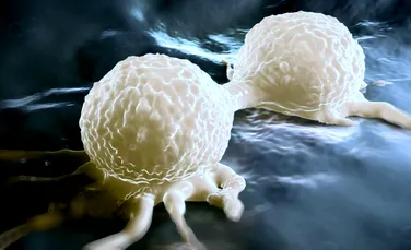 Celulele cancerului mamar au fost transformate, cu succes, în grăsime. Procesul opreşte apariţia metastazelor