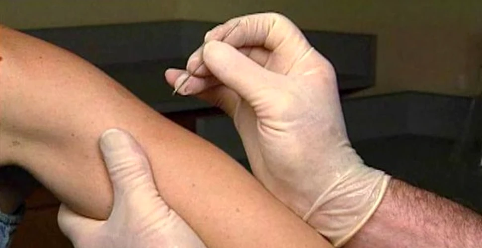 Sistarea vaccinarii anti-variolice a stimulat raspandirea HIV