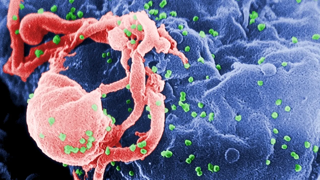 1-virusul-hiv-anticorpii 
