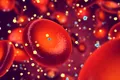 Oamenii de știință au descoperit că diabetul poate accelera cancerul de sânge