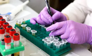 Cercetătorii de la MIT propun un nou test pentru cancerul pulmonar