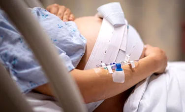 O femeie cu două utere a născut gemene în zile diferite