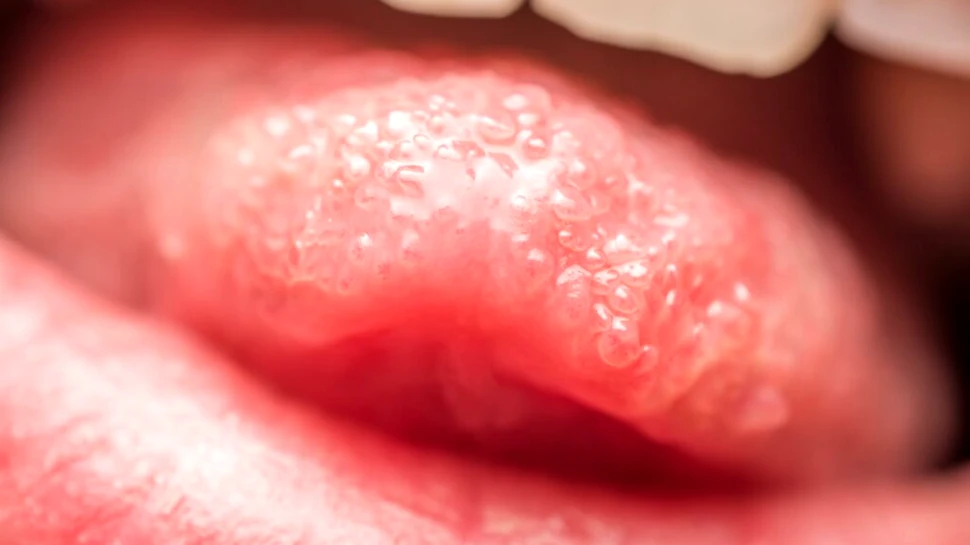 „Limba electronică” i-ar putea ajuta pe roboți să guste mâncarea la fel ca oamenii