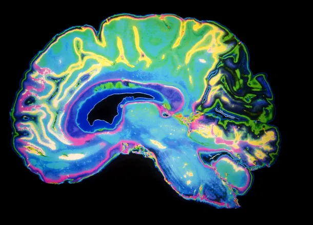 Cele mai populare mituri despre creierul uman