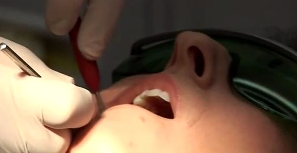Reacţia incredibilă a unei femei când îi este scoasă o măsea, fiind „anesteziată” doar prin auto-hipnoză (VIDEO)