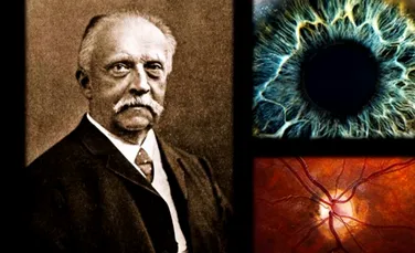 Neamţul care a schimbat pentru totdeauna oftalmologia