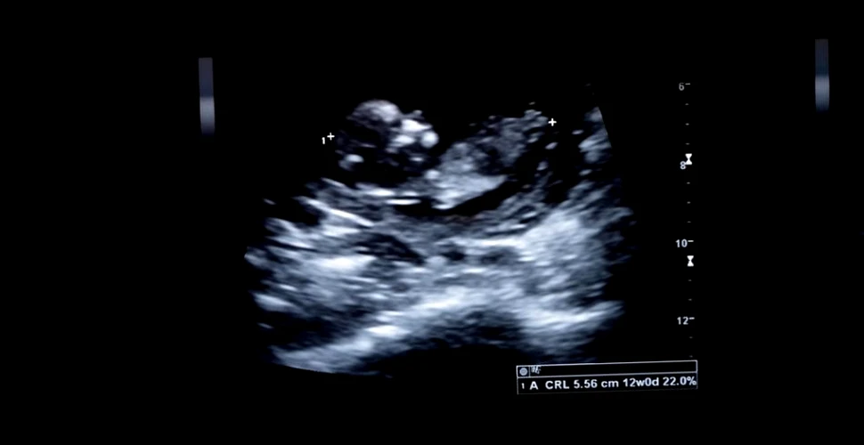 Este fetusul o persoană? Procesul care poate avea consecinţe majore