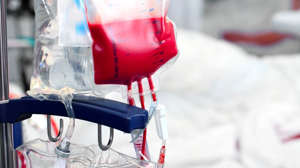 Cazul medical bizar în care sângele unui bărbat a devenit lăptos