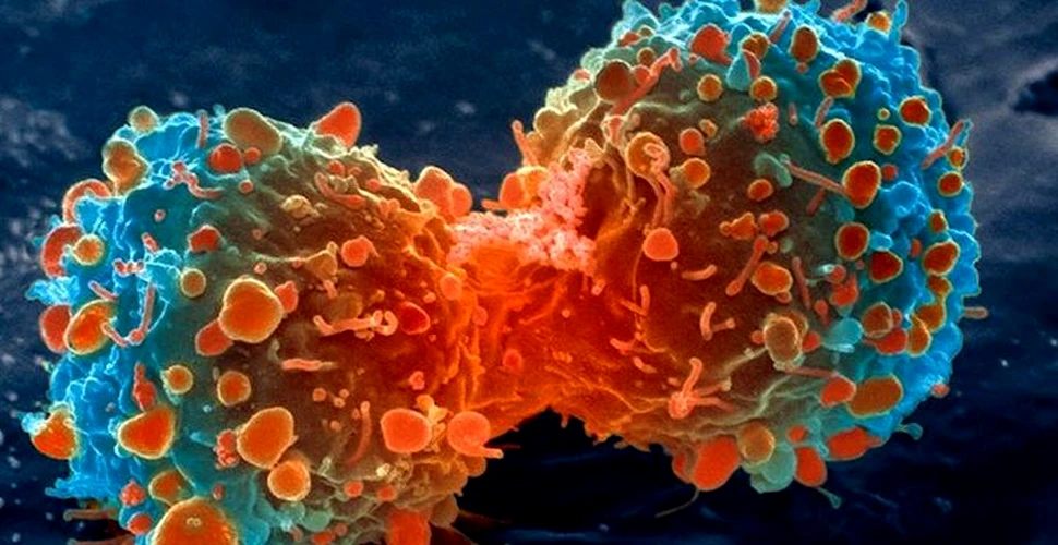 A fost descoperit anticorpul pentru cancer
