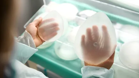 Răsturnare de tendință în chirurgia estetică: mai multe cereri de micșorare a sânilor decât implanturi