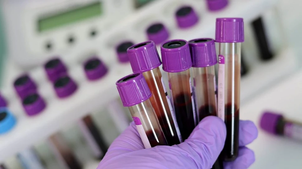 FT: Un studiu dezvăluie grupa de sânge cu risc mai redus de infectare cu noul coronavirus