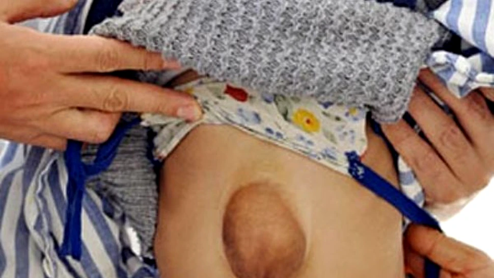 Soc in lumea medicala: copilul cu inima la vedere