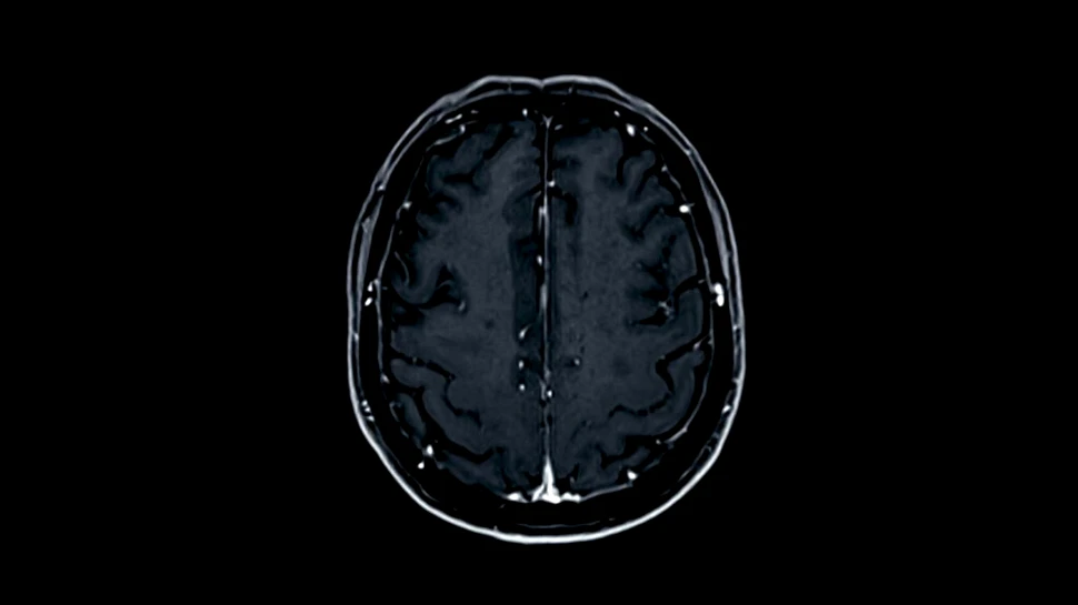 Un test de sânge îi poate ajuta pe medici să identifice mai bine severitatea leziunilor cerebrale