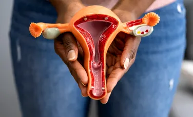 Progres „remarcabil” în tratarea cancerului de col uterin. Riscul de deces, redus cu 40%