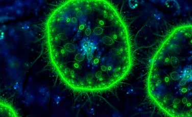 Microbii de la Fukushima duc o viață surprinzător de „obișnuită” în inima radiațiilor