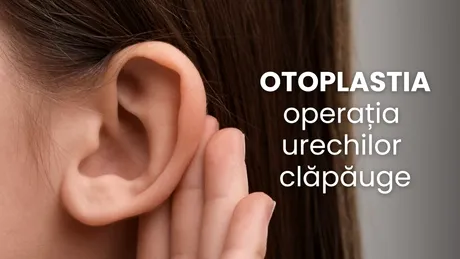 (P) Otoplastia (operația pentru urechi clăpăuge): când e momentul potrivit, cât costă și cum alegi chirurgul