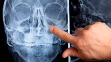 Semnul că sistemul tău respirator nu funcționează corect