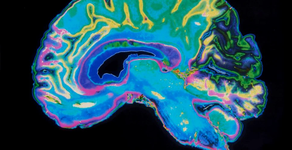 Premieră în neuroştiinţe: cercetătorii au putut urmări un gând care se ”mişca” prin creier