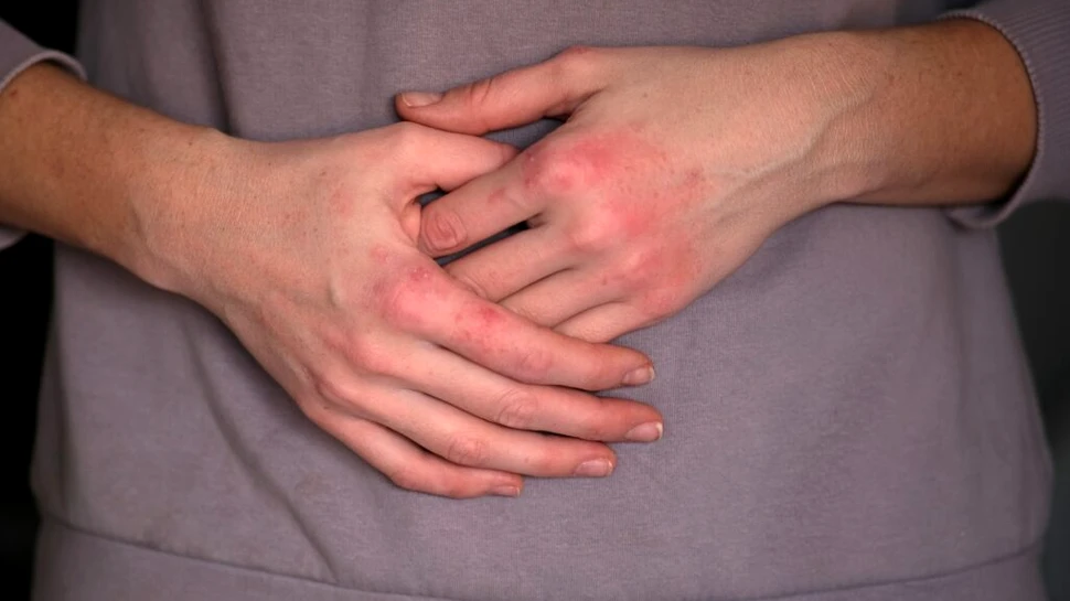 Inflamația din organism ar putea influența sănătatea mintală?