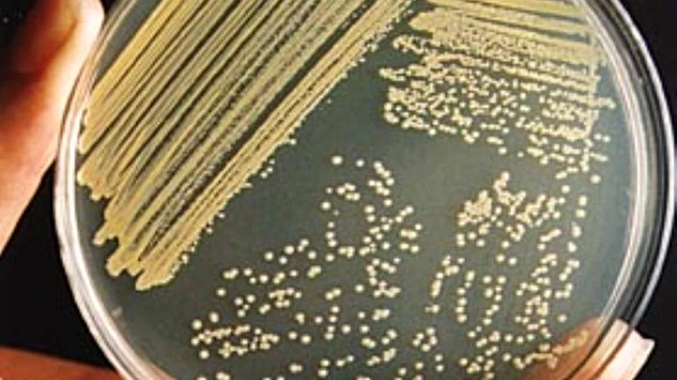 Bacteriile de la locul crimei