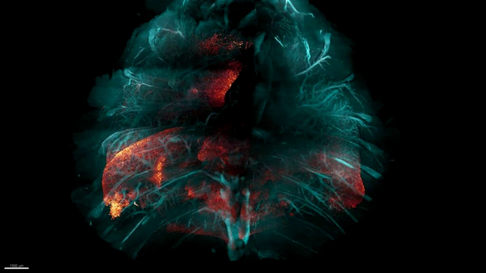 O nouă metodă de a face țesutul transparent ar putea accelera studiul bolilor