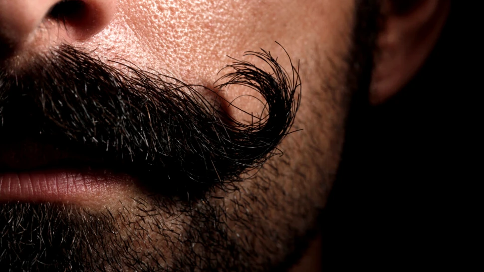 Transplantul de barbă: Între modă și capcană costisitoare